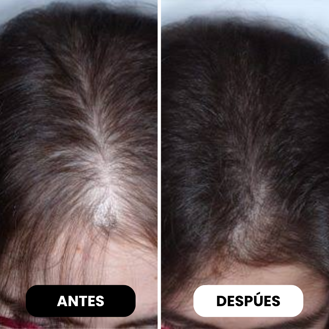 Polvo Capilar Rellenador Hairgo